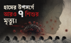 হামের উপসর্গে আরও ৭ শিশুর মৃত্যু